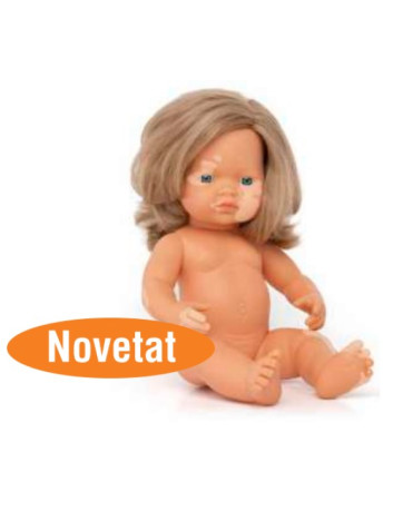 MUÑECA CON VITILIGO 38cms